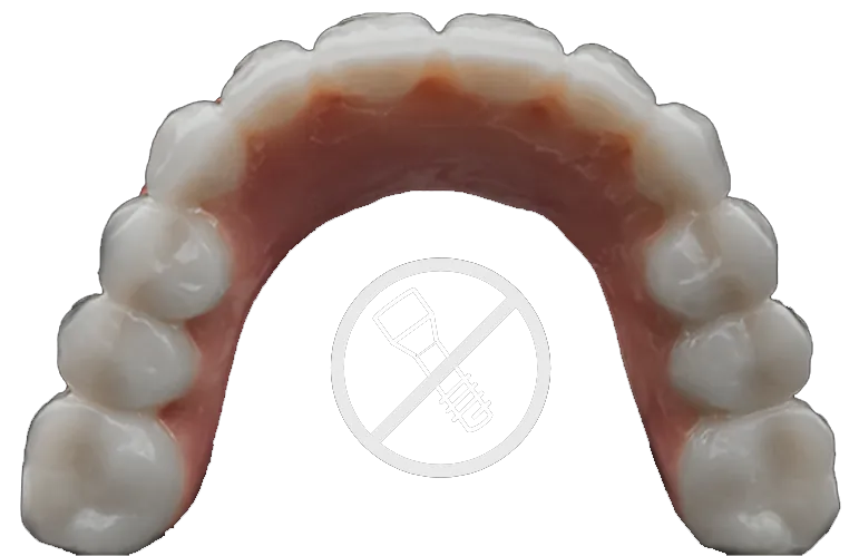Mouth with Smileloc implants that do not use screws.