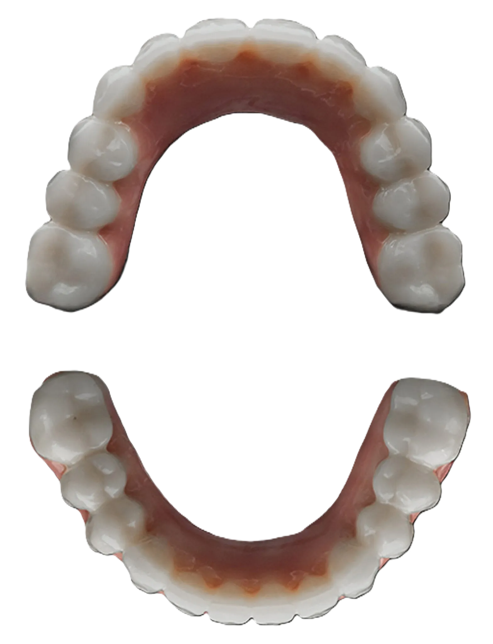 Your teeth with smileloc!