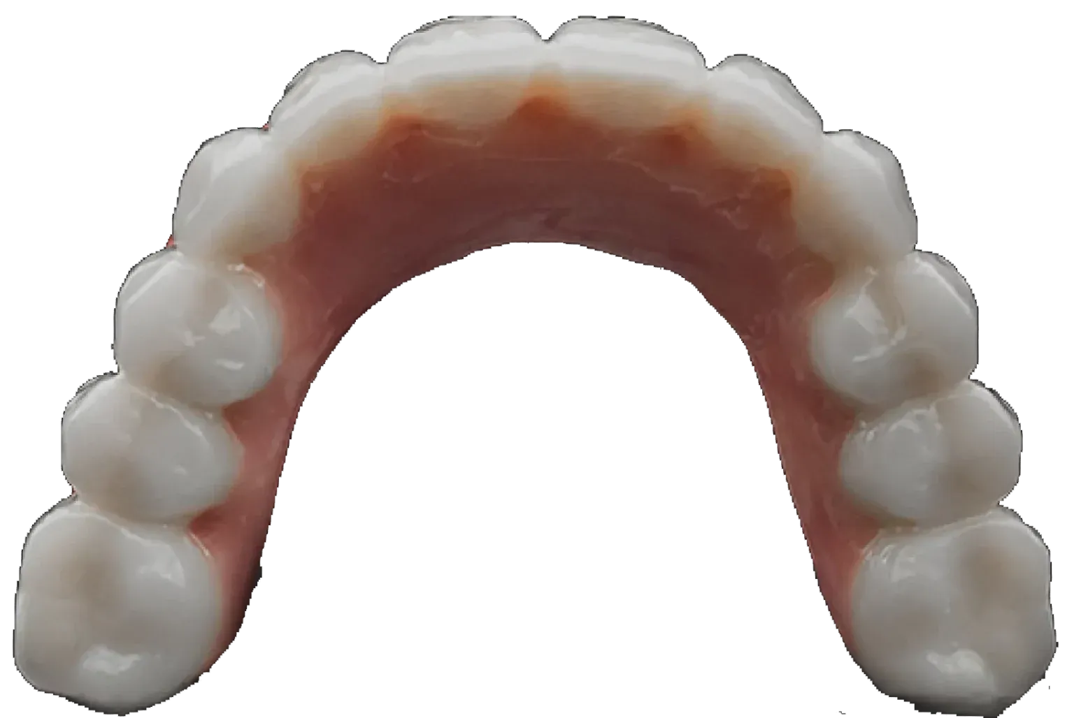 Top View of Teeth